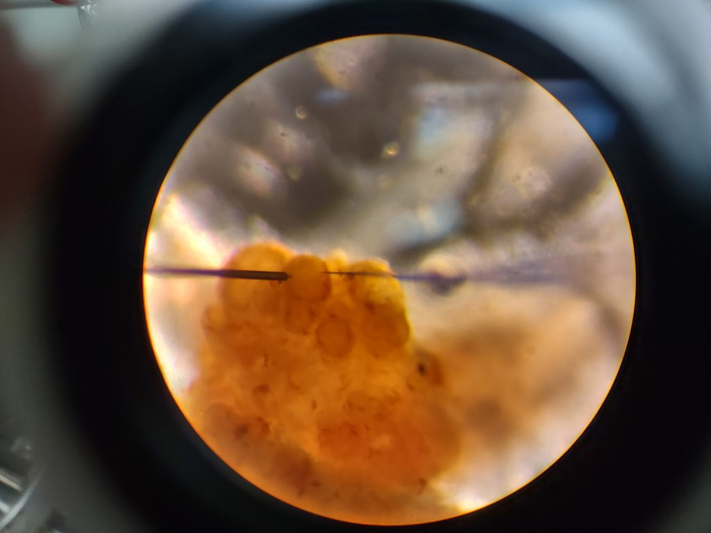 Microscope view of thermometer (left) and electrical needle (right) inside an animal neuron cell measuring simultaneously
